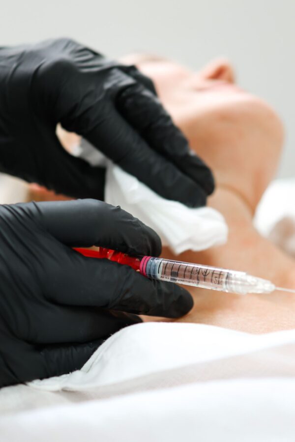 What Is The Recovery Time For Nefertiti Neck Lift In Surrey